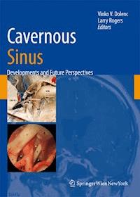 Cavernous Sinus -  - E-Book