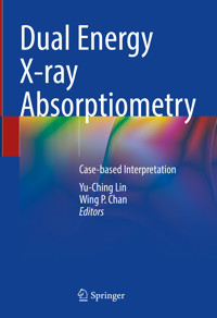 Dual Energy X-ray Absorptiometry -  - E-Book