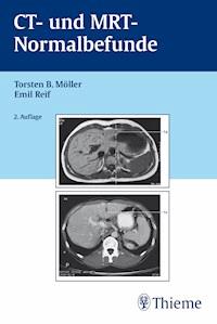 CT und MRT Normalbefunde - Torsten Bert Möller - E-Book