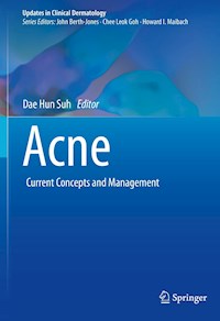Acne -  - E-Book