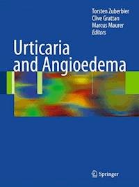 Urticaria and Angioedema - - E-Book