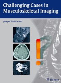 Challenging Cases in Musculoskeletal Imaging - Jürgen Freyschmidt - E-Book