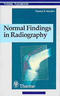 Normal Findings in Radiography - Torsten Bert Moeller - E-Book
