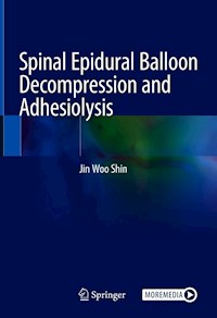 Spinal Epidural Balloon Decompression and Adhesiolysis - Jin Woo Shin - E-Book