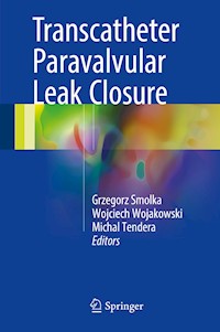 Transcatheter Paravalvular Leak Closure -  - E-Book