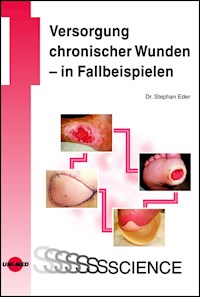 Versorgung chronischer Wunden - in Fallbeispielen - Stephan Eder - E-Book