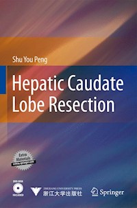 Hepatic Caudate Lobe Resection - Shu You Peng - E-Book