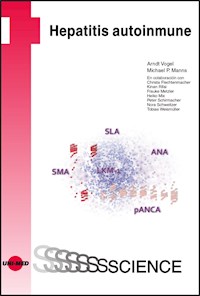 Hepatitis autoinmune - Arndt Vogel - E-Book