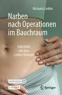 Narben nach Operationen im Bauchraum - Michaela Liedler - E-Book