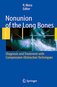 Nonunion of the Long Bones - - E-Book
