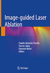 Image-guided Laser Ablation -  - E-Book
