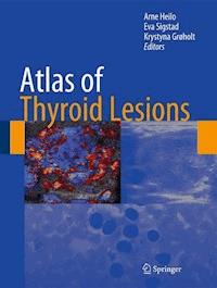 Atlas of Thyroid Lesions -  - E-Book