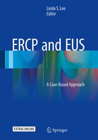 ERCP and EUS -  - E-Book