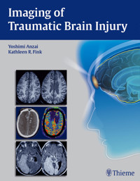 Imaging of Traumatic Brain Injury -  - E-Book