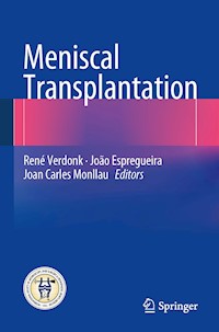Meniscal Transplantation -  - E-Book