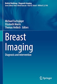 Breast Imaging -  - E-Book