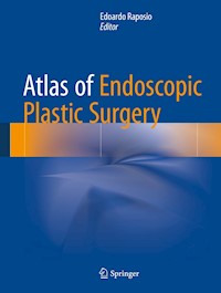 Atlas of Endoscopic Plastic Surgery -  - E-Book