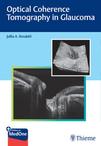 Optical Coherence Tomography in Glaucoma - Jullia Rosdahl - E-Book
