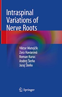 Intraspinal Variations of Nerve Roots - Viktor Matejčík - E-Book