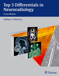 Top 3 Differentials in Neuroradiology - William T. O'Brien - E-Book