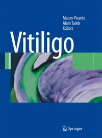 Vitiligo -  - E-Book