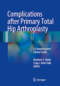 Complications after Primary Total Hip Arthroplasty -  - E-Book