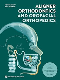 Aligner Orthodontics and Orofacial Orthopedics - Werner Schupp - E-Book