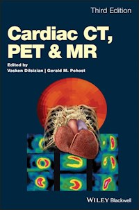 Cardiac CT, PET and MR -  - E-Book
