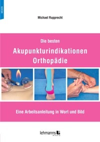 Die besten Akupunkturindikationen Orthopädie - Michael Rupprecht - E-Book