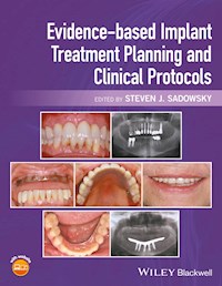 Evidence-based Implant Treatment Planning and Clinical Protocols - - E-Book