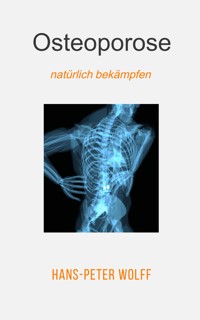 Osteoporose natürlich bekämpfen - Hans-Peter Wolff - E-Book