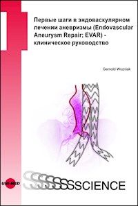 First steps in EVAR - a clinical guide - Russian edition - Gernold Wozniak - E-Book