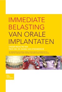 Immediate belasting van orale implantaten - D. Steenberghe - E-Book