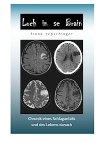 Loch in se Brain - Frank Repschläger - E-Book