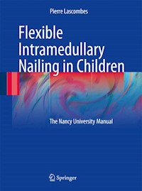 Flexible Intramedullary Nailing in Children - Pierre Lascombes - E-Book