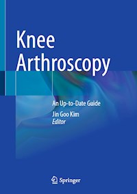 Knee Arthroscopy -  - E-Book