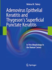 Adenovirus Epithelial Keratitis and Thygeson's Superficial Punctate Keratitis - Helena M. Tabery - E-Book