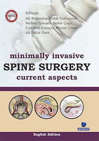 Minimally Invasive Spine Surgery Current Aspects - Ali Arslantaş - E-Book