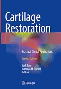 Cartilage Restoration -  - E-Book