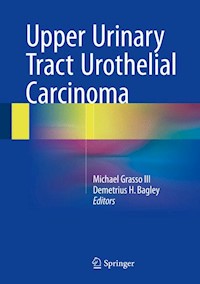 Upper Urinary Tract Urothelial Carcinoma -  - E-Book