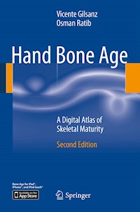 Hand Bone Age - Vicente Gilsanz - E-Book