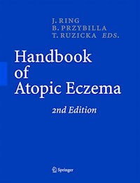 Handbook of Atopic Eczema -  - E-Book