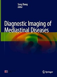 Diagnostic Imaging of Mediastinal Diseases - - E-Book