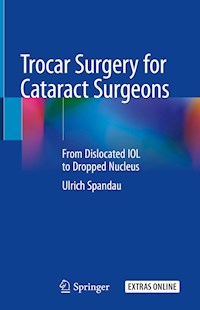 Trocar Surgery for Cataract Surgeons - Ulrich Spandau - E-Book