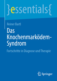 Das Knochenmarködem-Syndrom - Reiner Bartl - E-Book