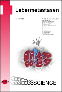 Lebermetastasen - Matthias Birth - E-Book