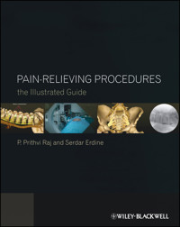 Pain-Relieving Procedures - P. Prithvi Raj - E-Book