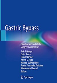 Gastric Bypass -  - E-Book