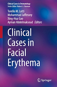 Clinical Cases in Facial Erythema -  - E-Book
