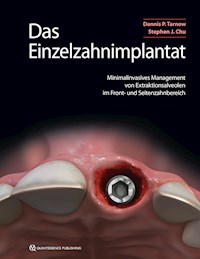 Das Einzelzahnimplantat - Dennis P. Tarnow - E-Book